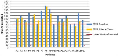 Multiple Breath Washout for Early Assessment of Pulmonary Complications in Patients With Primary Antibody Deficiencies: An Observational Study in Pediatric Age